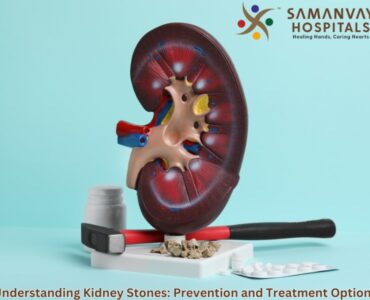 Understanding Kidney Stones