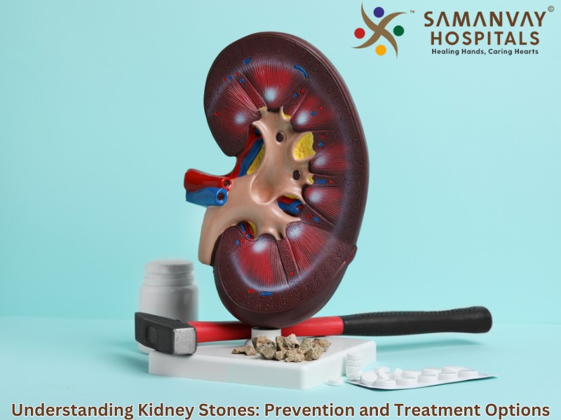 Understanding Kidney Stones: Prevention and Treatment Options