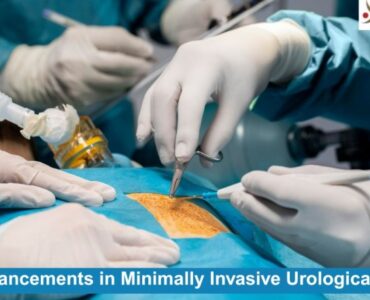 Minimally Invasive Urological Surgeries