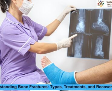 Bone Fractures