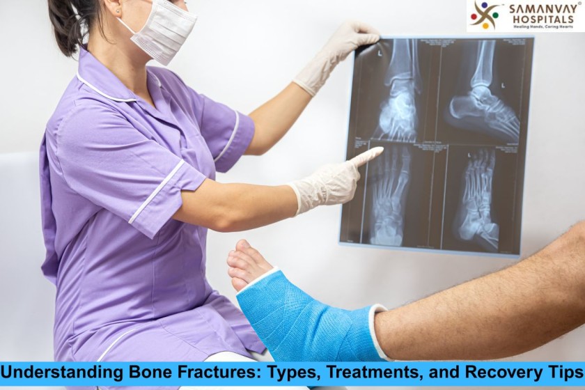 Understanding Bone Fractures: Types, Treatments, and Recovery Tips