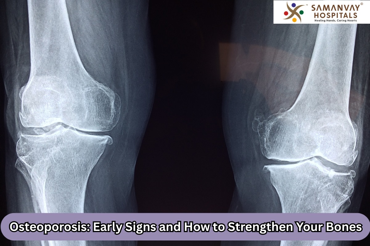 Osteoporosis: Early Signs and How to Strengthen Your Bones