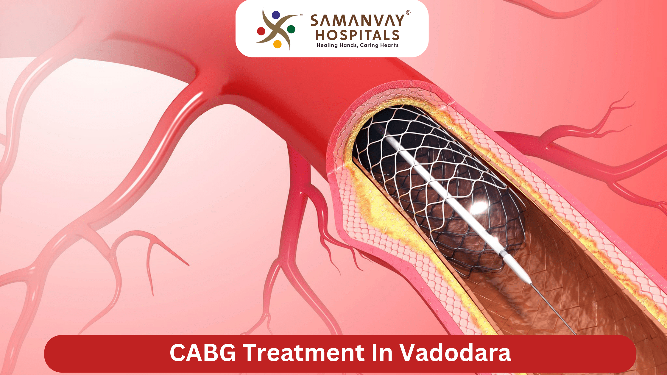 CABG Treatment In Vadodara
