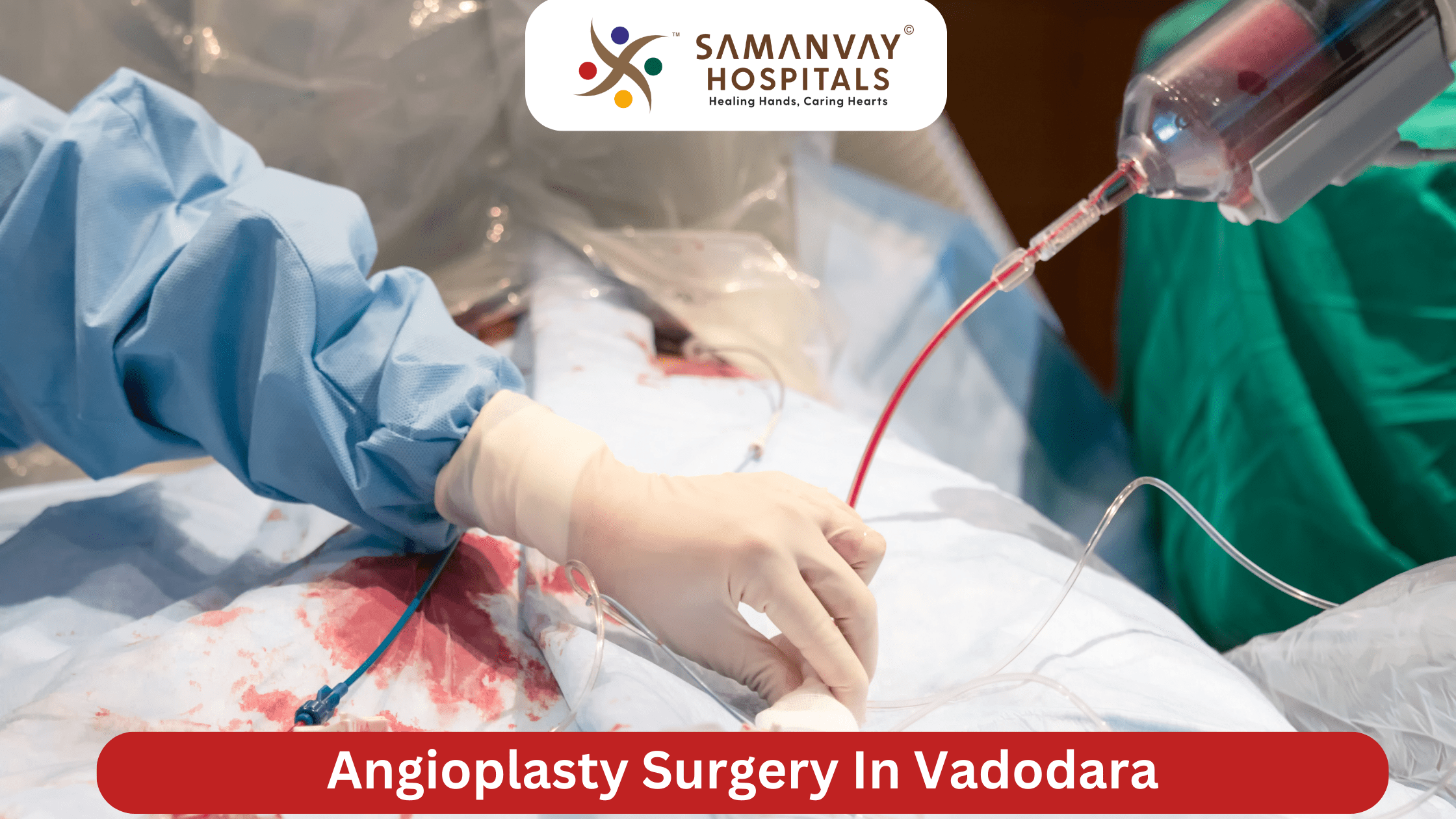 Angioplasty Surgery in Vadodara Advanced Cardiac Care for Heart Blockage Treatment