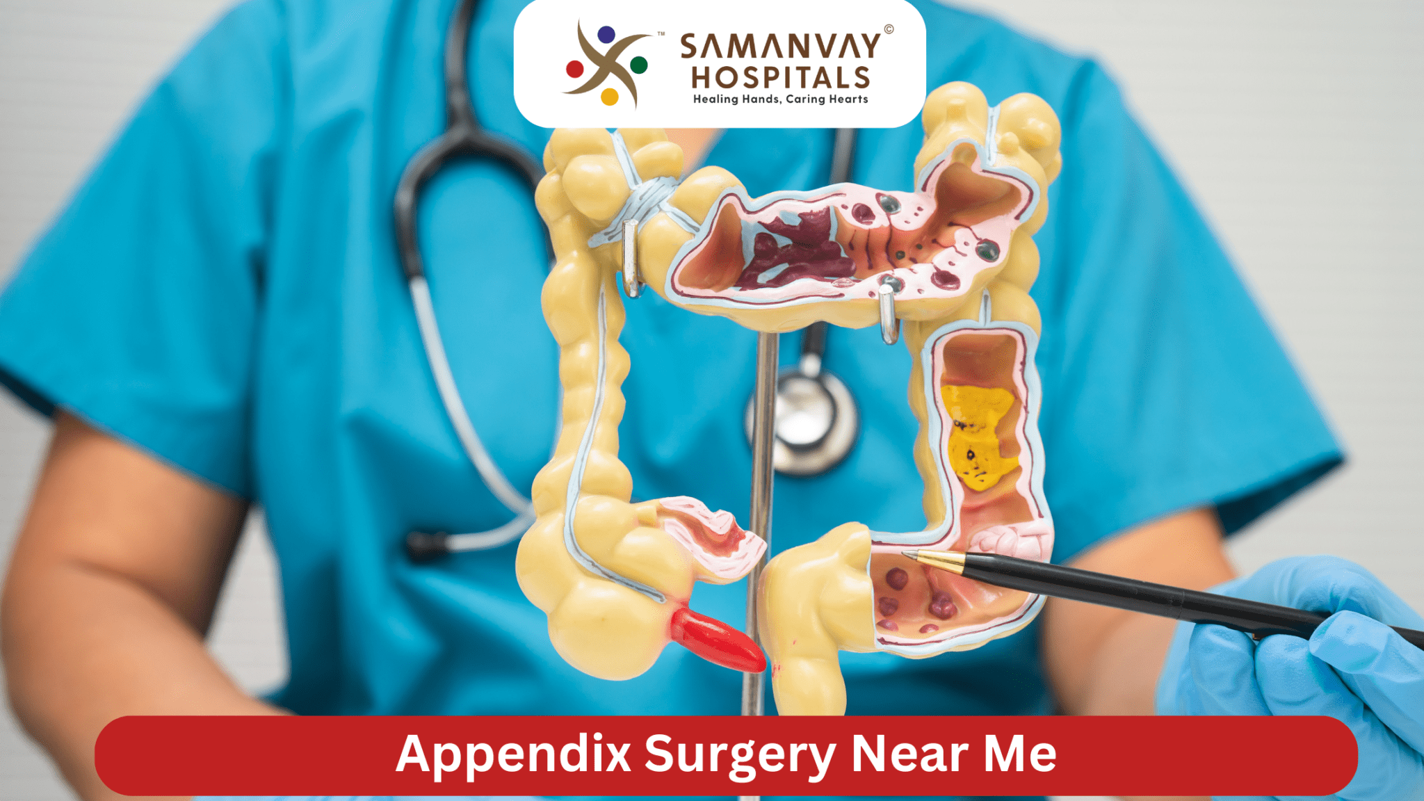 Appendix Surgery Near Me | Samanvay Hospital Vadodara
