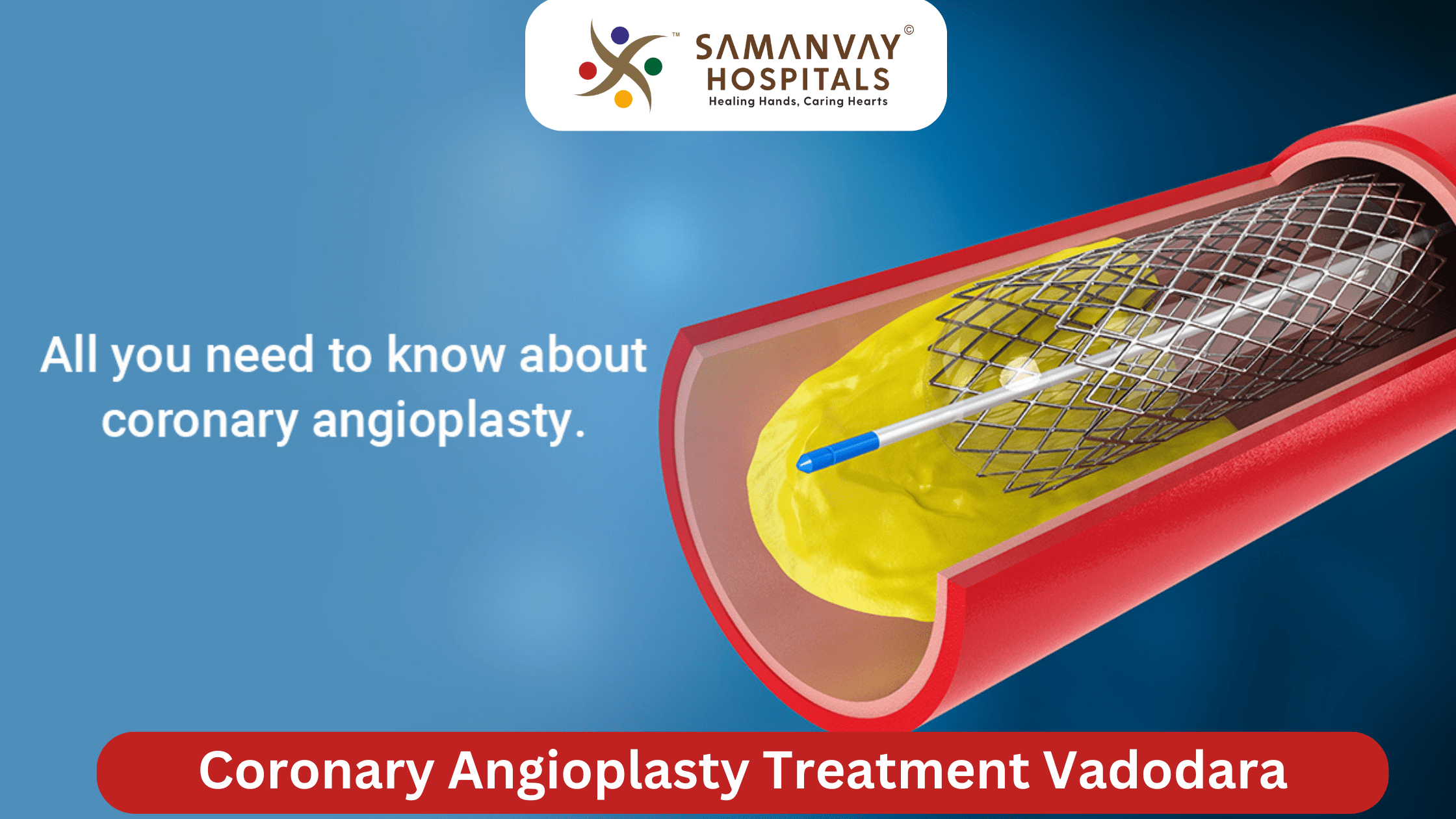 Coronary Angioplasty Treatment Vadodara –Advanced Heart Care for a Healthier Life