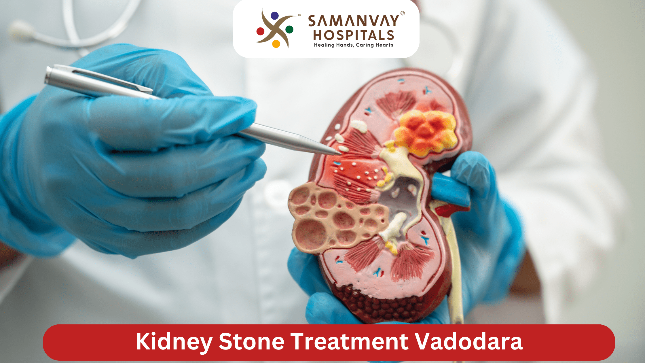 Kidney Stone Treatment Vadodara Advanced & Minimally Invasive Urology Care
