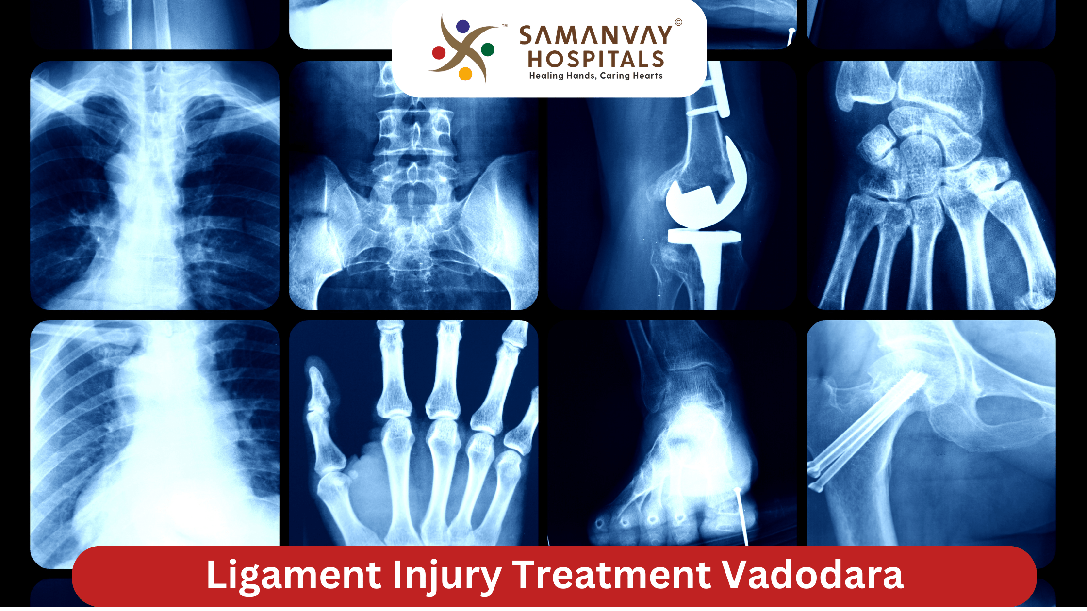 Ligament Injury Treatment Vadodara