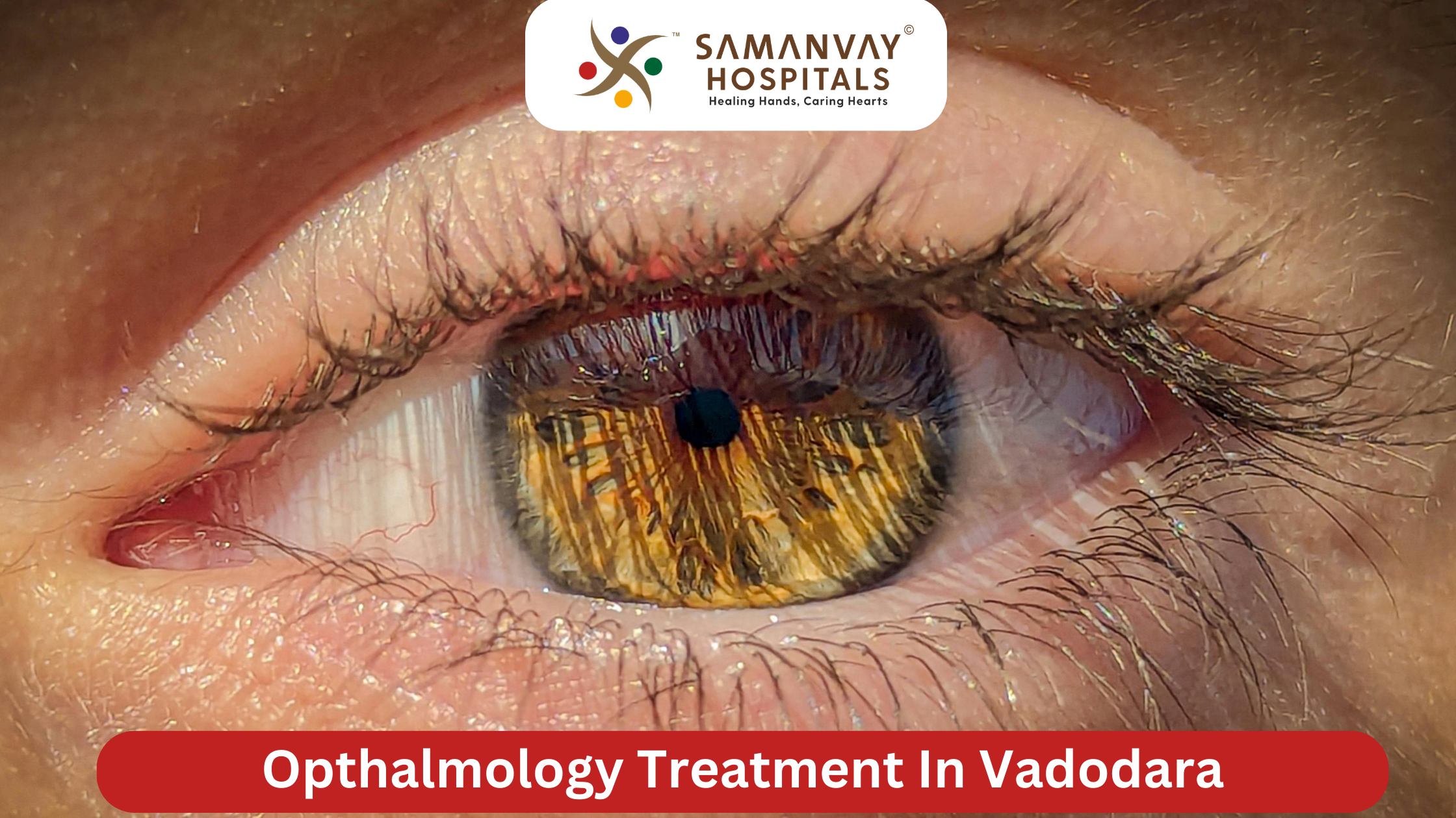 Ophthalmology Treatment in Vadodara – Advanced Eye Care for Clearer Vision