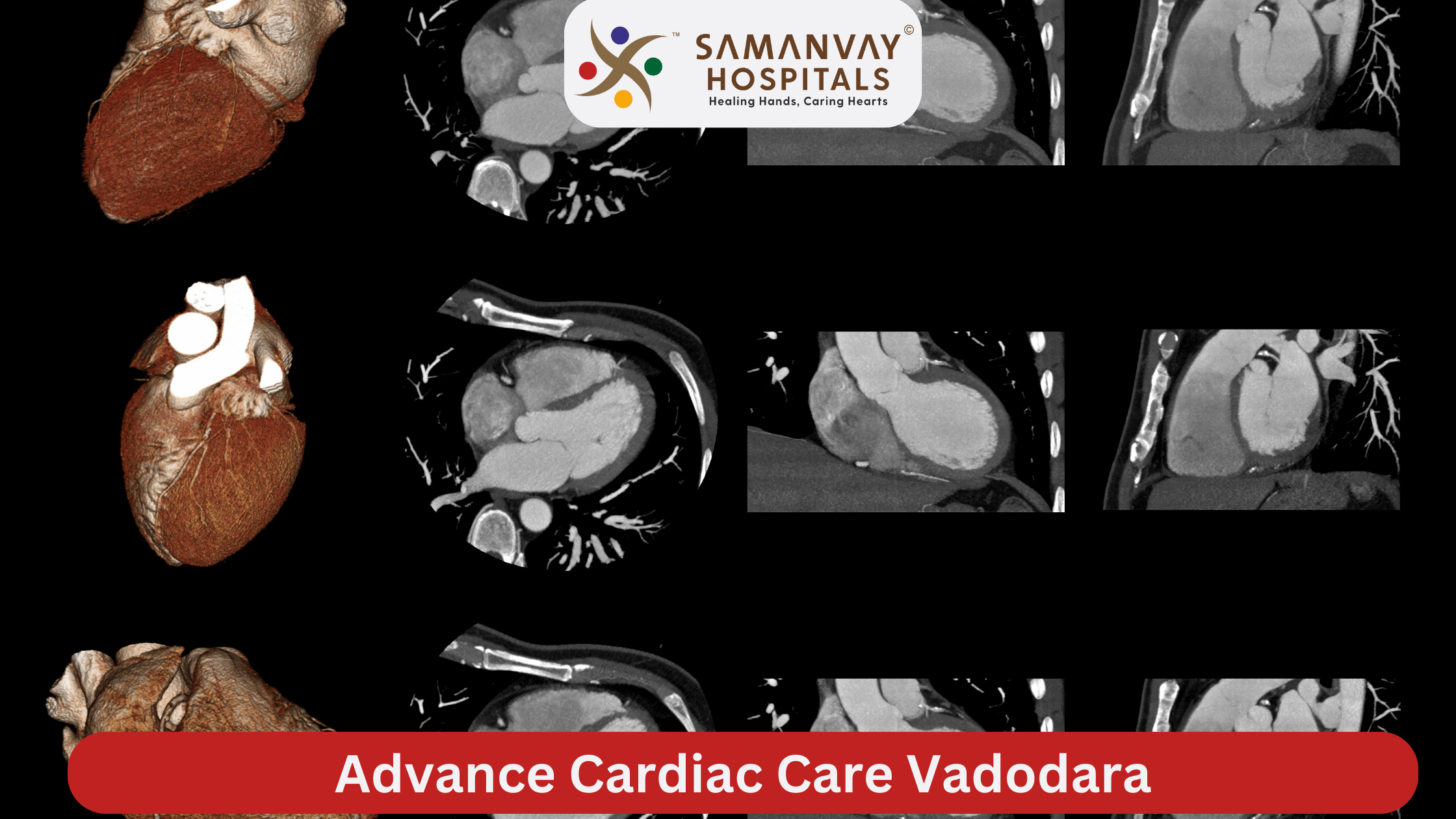 Advance Cardiac Care Vadodara: Excellence at Samanvay Hospital