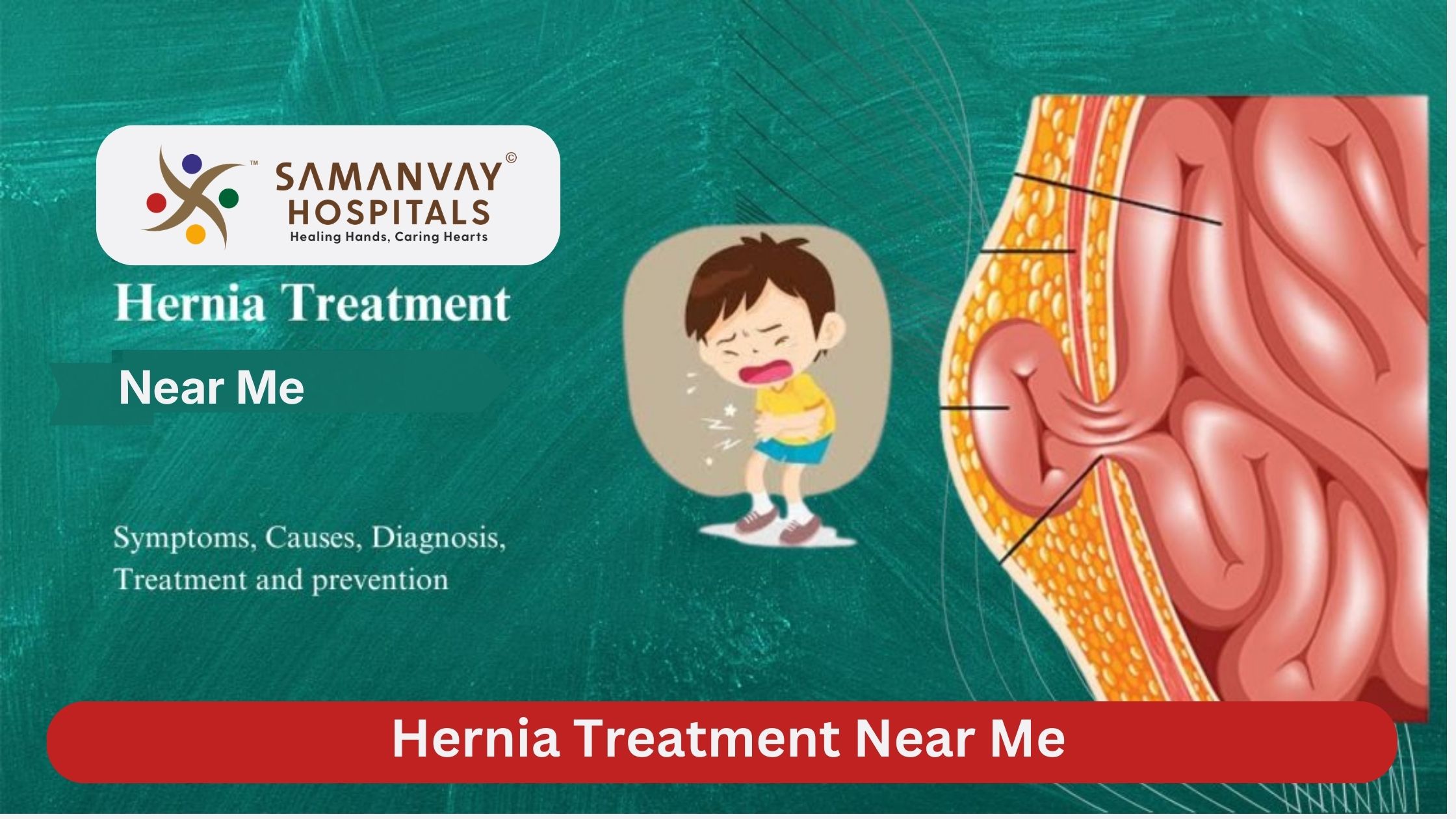 Hernia Treatment Near Me: Modern Solutions for Lasting Relief
