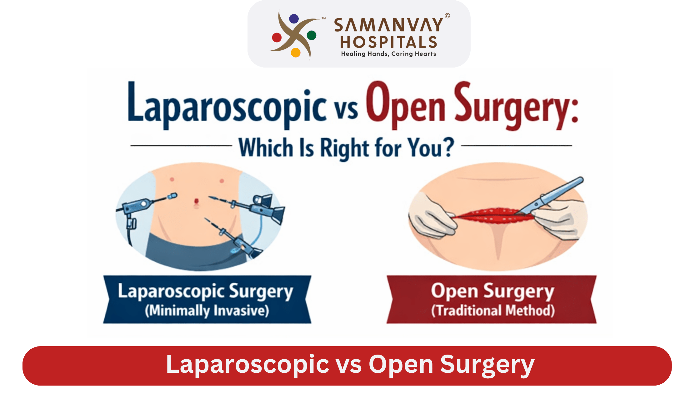 Laparoscopic vs. Open Surgery: Making the Right Choice for Your Recovery