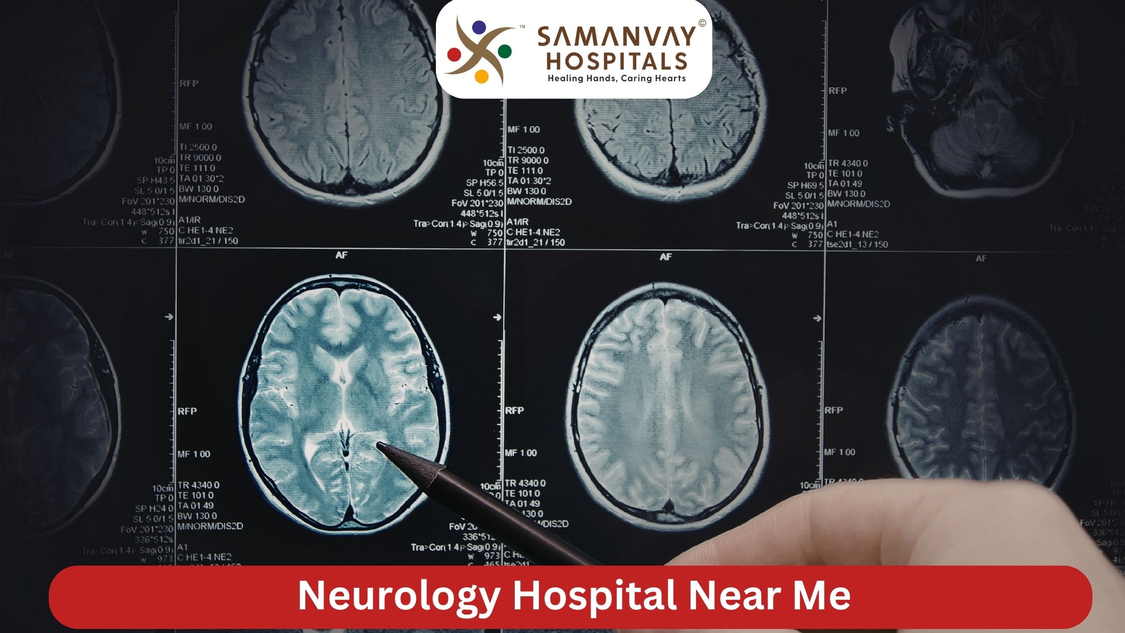 Neurology Hospital Near Me: Advanced Brain and Nerve Care at Samanvay Hospital