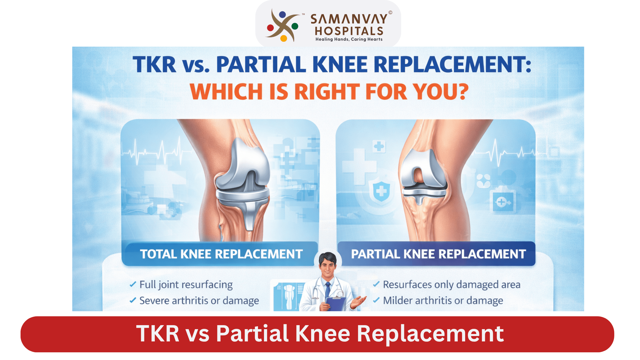 TKR vs. Partial Knee : A Complete Guide to Regaining Your Mobility
