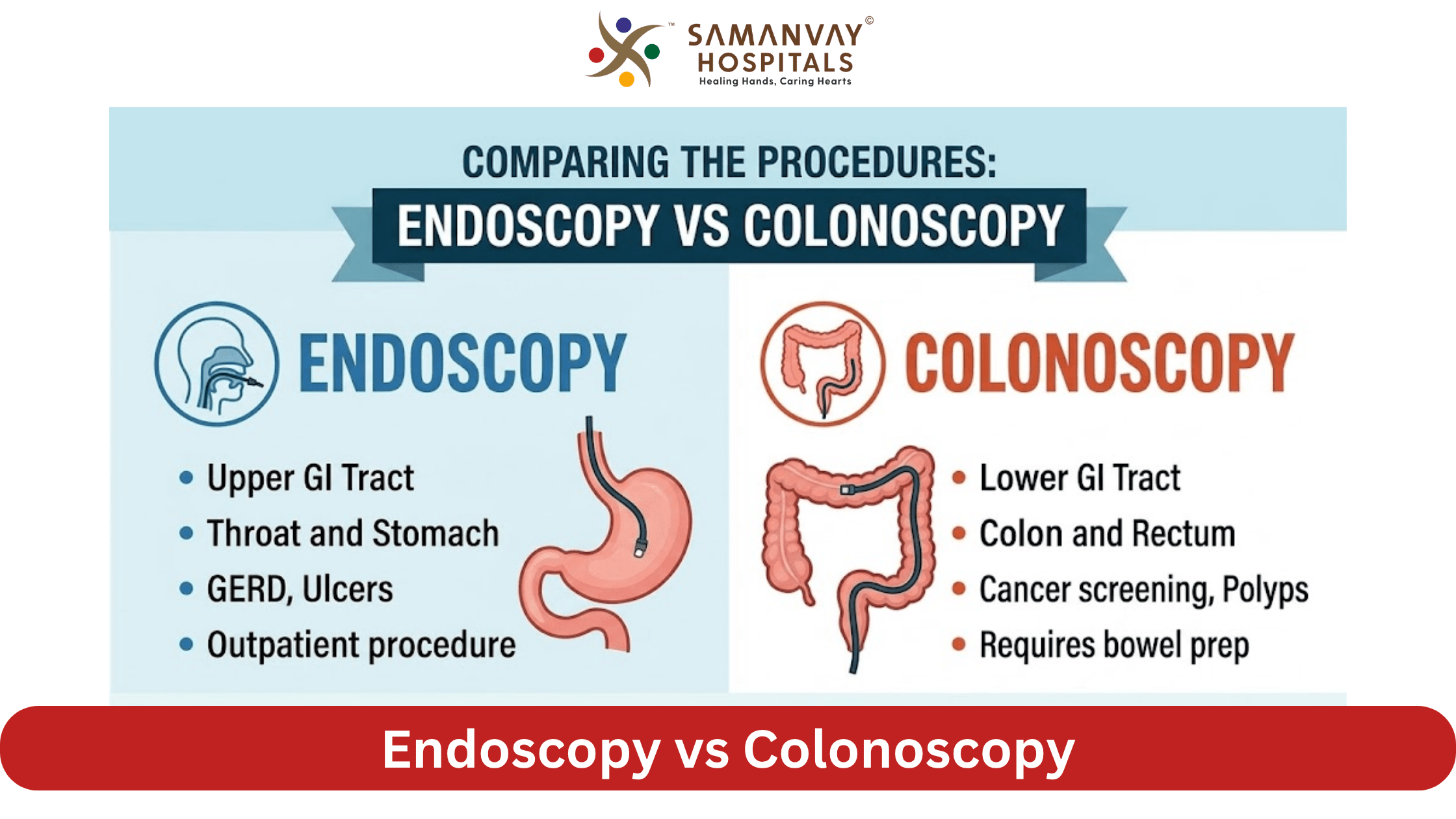 Endoscopy vs Colonoscopy Processes