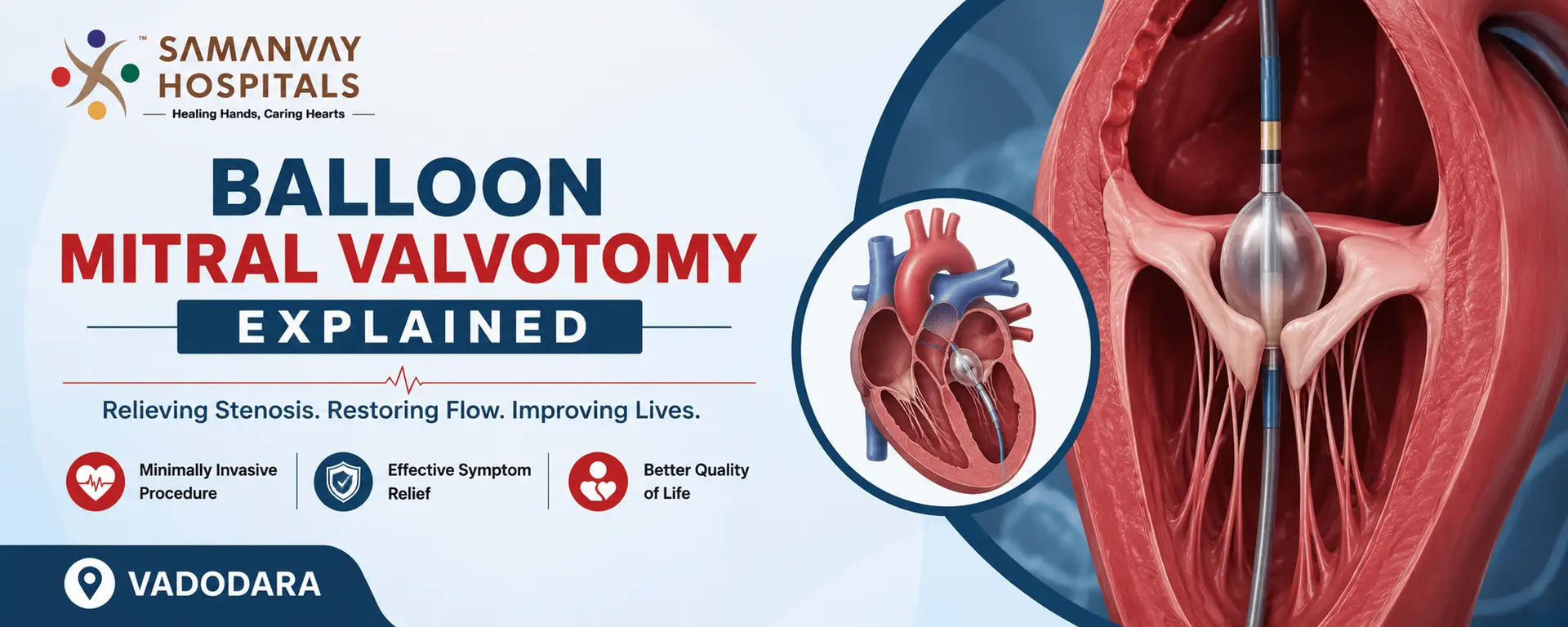 Balloon Mitral Valvotomy Explained