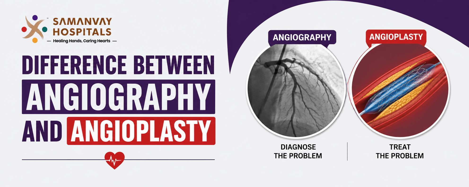 Difference Between Angiography And Angioplasty