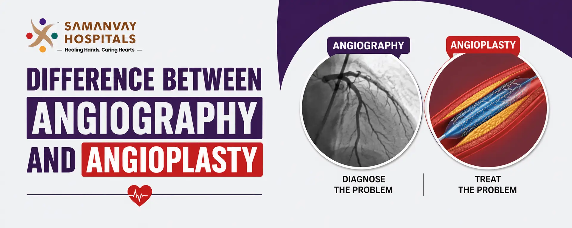 Difference Between Angiography And Angioplasty