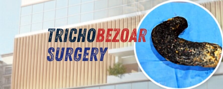 trichobezore surgery