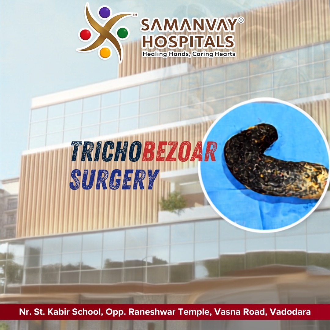 Gastric Trichobezoar Surgery in Vadodara