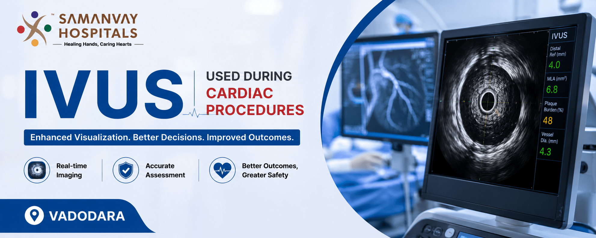IVUS Used During Cardiac Procedures: Advancing Precision In Modern Heart Care