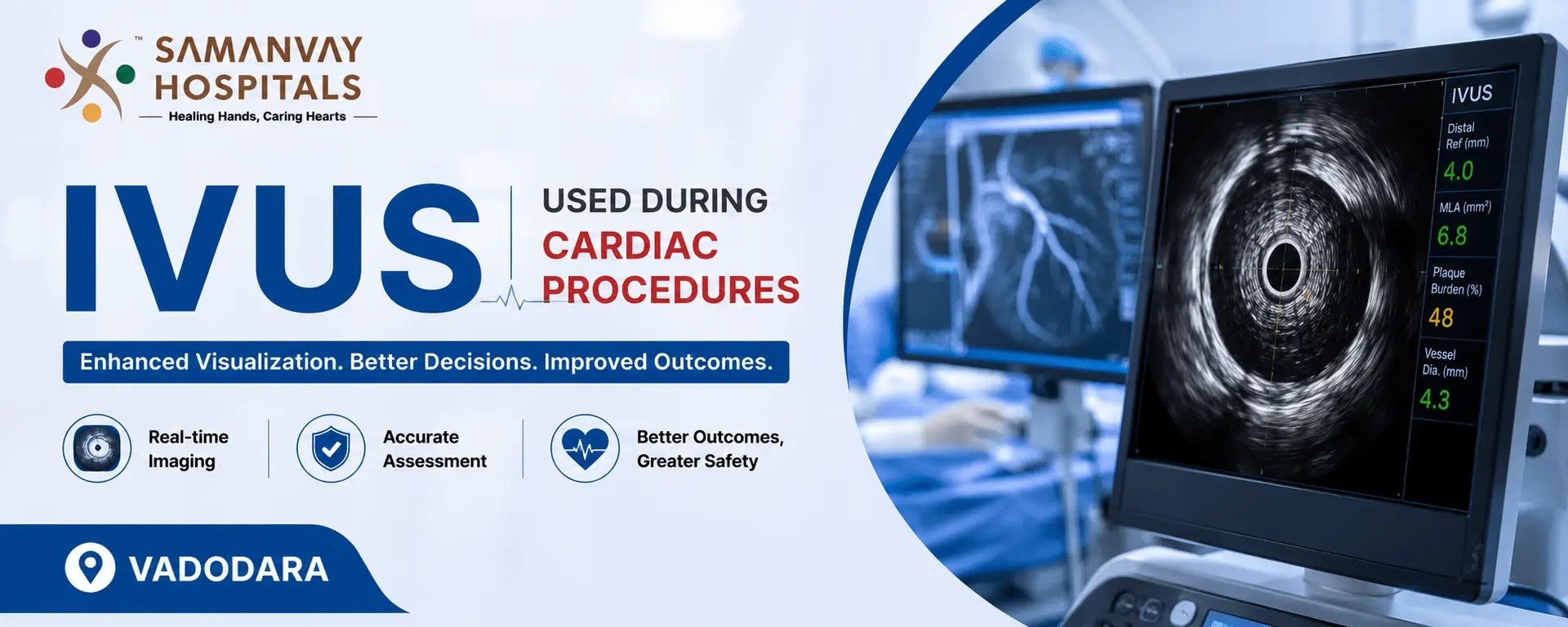 IVUS Used During Cardiac Procedures: