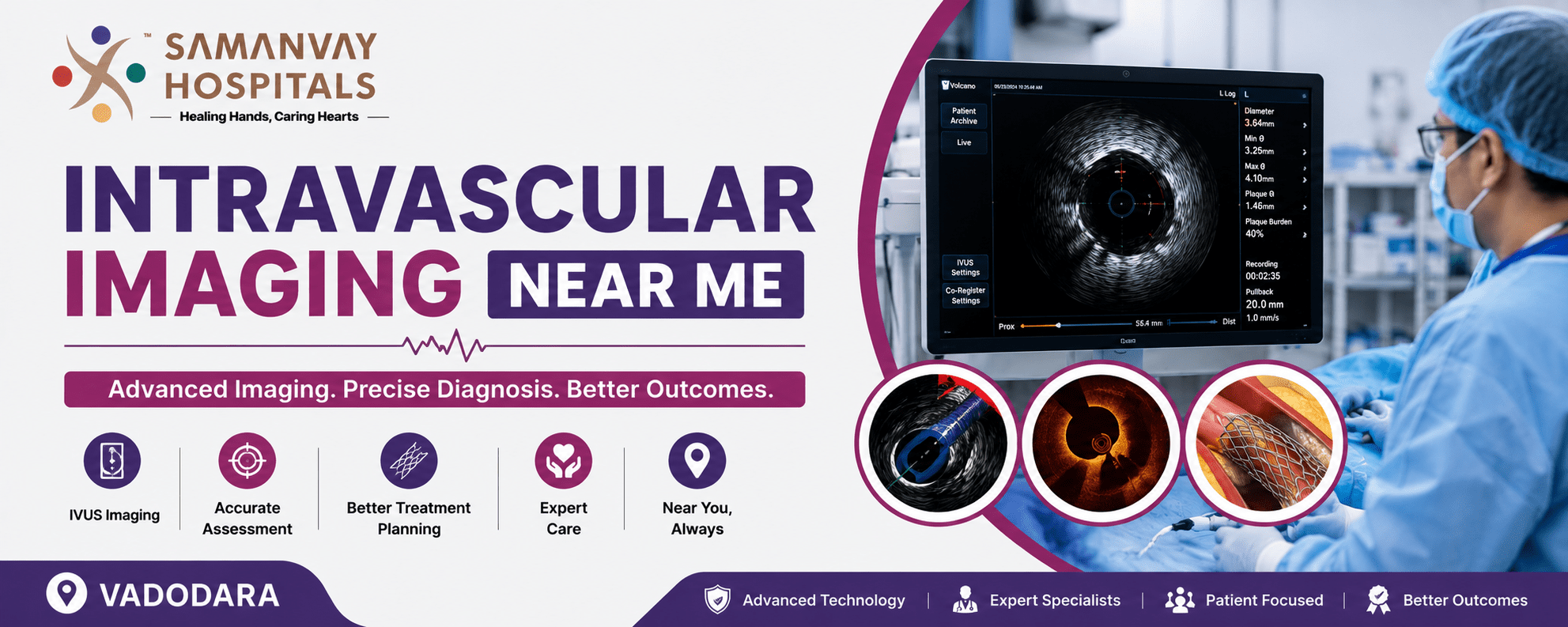 Intravascular Imaging Near Me: How Advanced IVUS Technology Is Transforming Cardiac Care