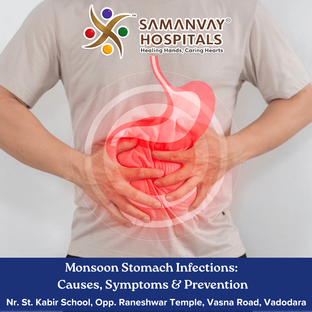 Monsoon Stomach Infections: Causes, Symptoms & Prevention