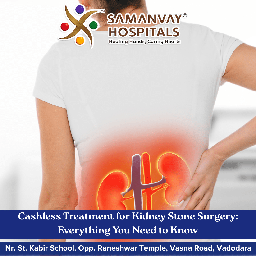 Cashless Treatment for Kidney Stone Surgery: Everything You Need to Know