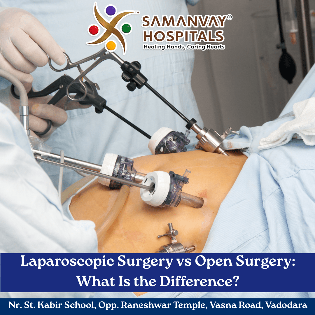 laparoscopic-surgery-vadodara-samanvay-hospitals.jpg