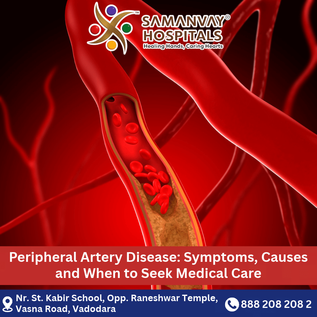 Peripheral Artery Disease: Symptoms, Causes and When to Seek Medical Care